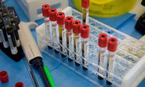 lab analisi
