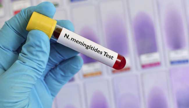 test meningite